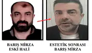 Yüzünü Değiştirip Kaçtı: 7 Yıllık Firari Cinayet Zanlısı Yakalandı