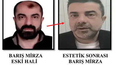 Yüzünü Değiştirip Kaçtı: 7 Yıllık Firari Cinayet Zanlısı Yakalandı