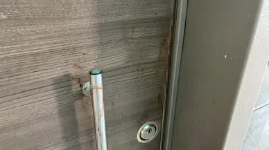 Ankara Akyurt’ta Bıçaklı Saldırı: 4 Yaralının Tedavisi Sürüyor