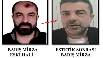 Yüzünü Değiştirip Kaçtı: 7 Yıllık Firari Cinayet Zanlısı Yakalandı