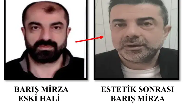 Yüzünü Değiştirip Kaçtı: 7 Yıllık Firari Cinayet Zanlısı Yakalandı