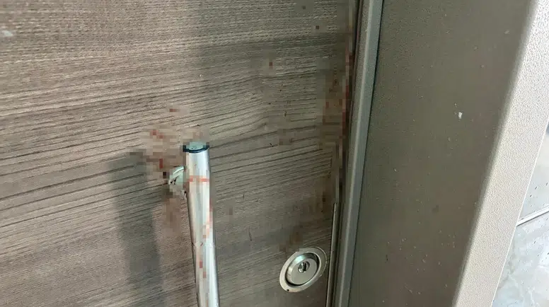 Ankara Akyurt’ta Bıçaklı Saldırı: 4 Yaralının Tedavisi Sürüyor